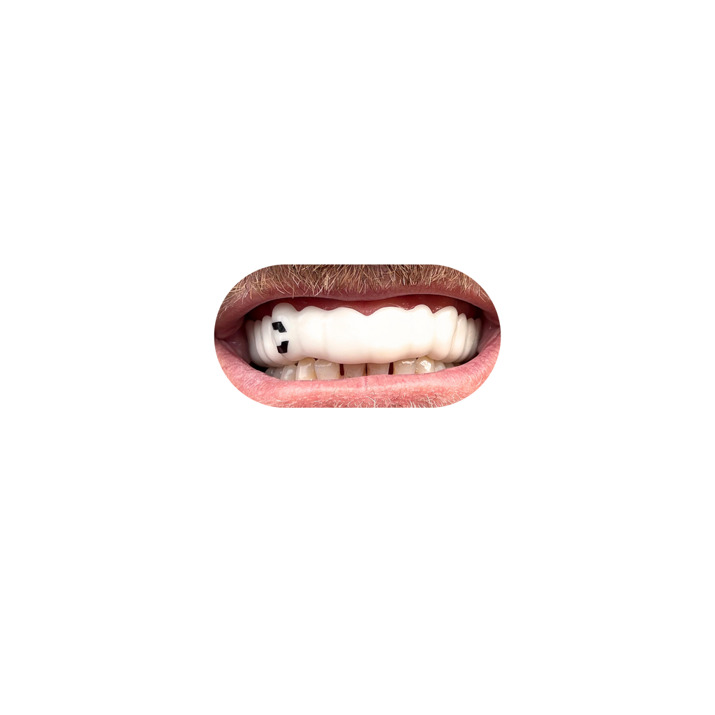 Sports Mouthguard (Lightweight)